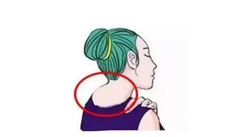 富貴包怎樣徹底消除,富貴包拔罐會好嗎?