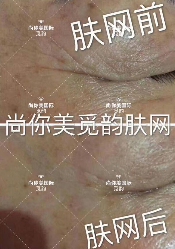 美白面膜哪個牌子的效果好價格便宜點