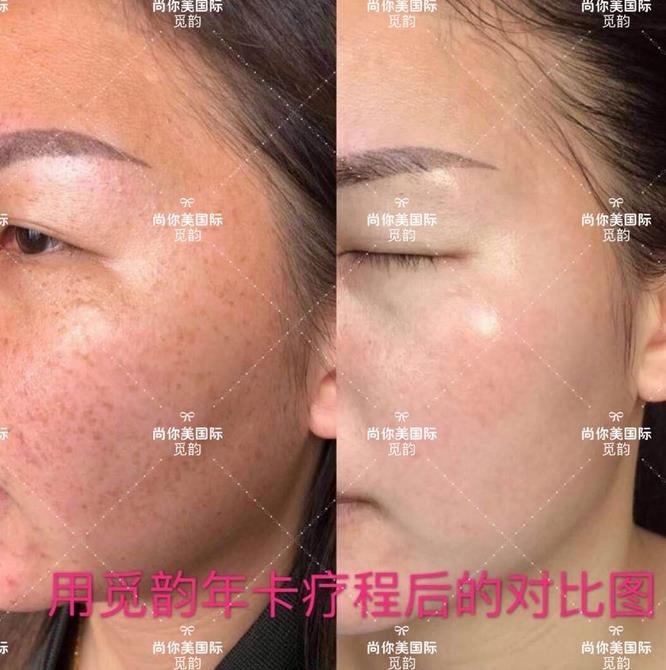 美白面膜哪個牌子的效果好價格便宜點