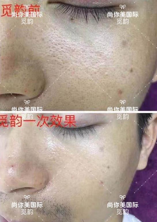美白面膜哪個牌子的效果好價格便宜點