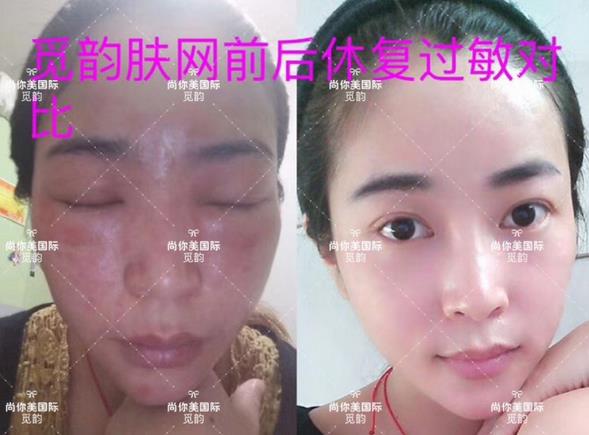 美白面膜哪個牌子的效果好價格便宜點